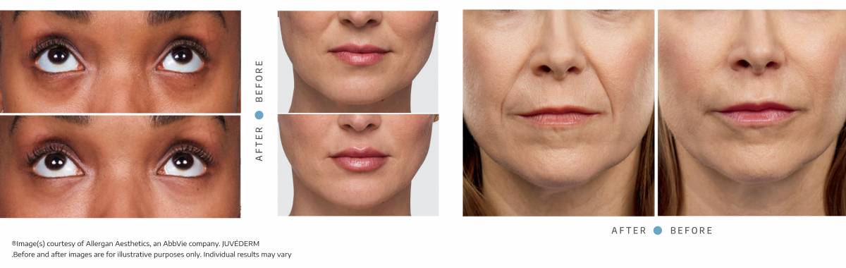 Special of the Month