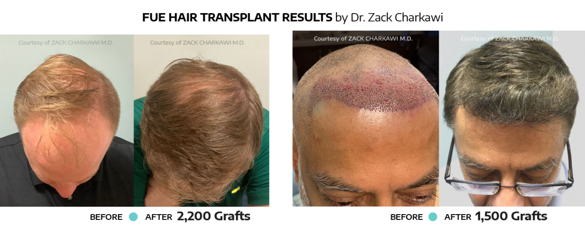 Special of the Month